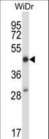 STEAP1 / STEAP Antibody - STEAP1 Antibody western blot of WiDr cell line lysates (35 ug/lane). The STEAP1 antibody detected the STEAP1 protein (arrow).