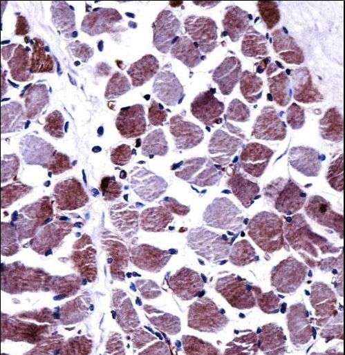 STEAP1 / STEAP Antibody - STEAP1 Antibody immunohistochemistry of formalin-fixed and paraffin-embedded human skeletal muscle followed by peroxidase-conjugated secondary antibody and DAB staining.