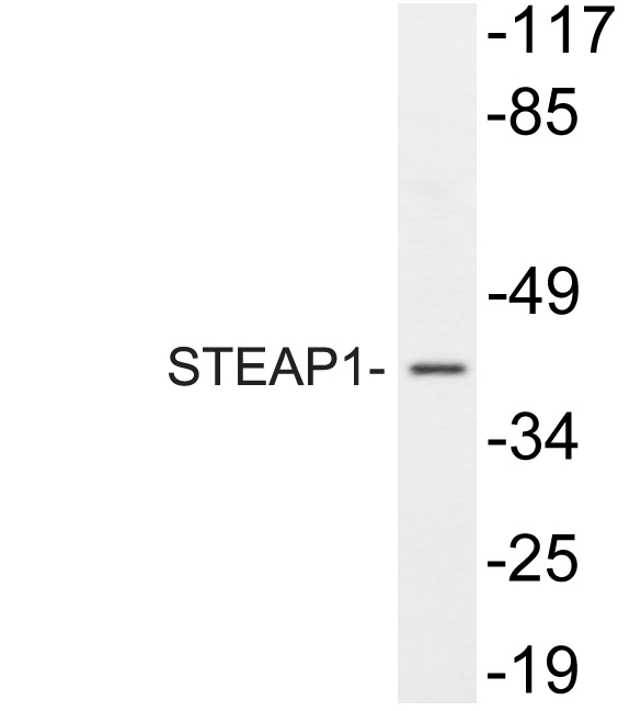 STEAP1 / STEAP Antibody - Western blot of STEAP1 (D31) pAb in extracts from A549.