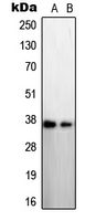 STEAP1 / STEAP Antibody - Western blot analysis of STEAP1 expression in LNCaP (A); A431 (B) whole cell lysates.