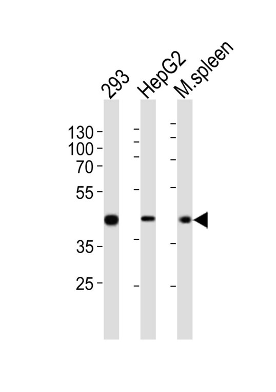 STEAP2 Antibody - Western blot of lysates from 293, HepG2 cell line, mouse spleen tissue lysate (from left to right), using STEA2 Antibody. Antibody was diluted at 1:1000 at each lane. A goat anti-rabbit IgG H&L (HRP) at 1:10000 dilution was used as the secondary antibody. Lysates at 20ug per lane.