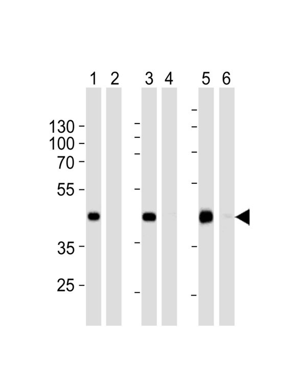 STEAP2 Antibody - Western blot of extracts from 293 (lanes 1 and 2),HepG2 (lanes 3 and 4)cell line and mouse spleen (lanes 5 and 6)tissue lysate: 1, 3, 5. using STEA2 Antibody , (1:500). 2, 4, 6. using STEA2 Antibody , preincubated with the control peptide antigen.