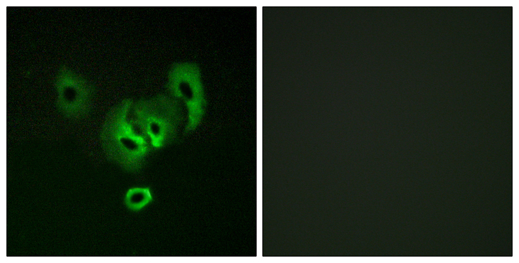 STEAP2 Antibody - Immunofluorescence analysis of A549 cells, using STEA2 Antibody. The picture on the right is blocked with the synthesized peptide.