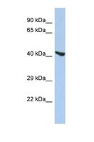 STEAP2 Antibody - Western blot of Human HepG2. STEAP2 antibody dilution 1.0 ug/ml.  This image was taken for the unconjugated form of this product. Other forms have not been tested.