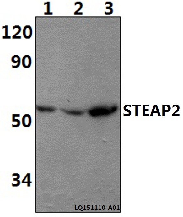 STEAP2 Antibody - Western blot of STEAP2 polyclonal antibody at 1:500 dilution. Lane 1: HEH293T whole cell lysate (40 ug). Lane 2: The Spleen tissue lysate of Rat(30 ug). Lane 3: The Spleen tissue lysate of Mouse(30 ug).