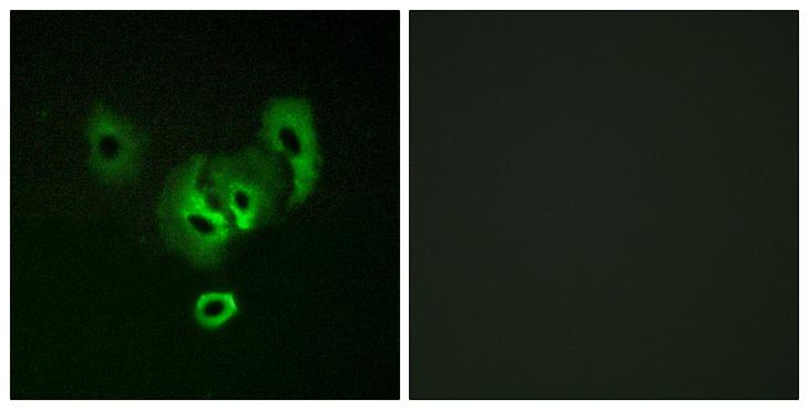 STEAP2 Antibody - Peptide - + Immunofluorescence analysis of A549 cells, using STEA2 antibody.