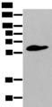 STEAP2 Antibody - Western blot analysis of Human prostate tissue  using STEAP2 Polyclonal Antibody at dilution of 1:400