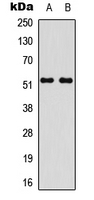 STEAP4 Antibody - Western blot analysis of STEAP4 expression in Jurkat (A); human liver (B) whole cell lysates.