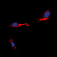 STEAP4 Antibody - Immunofluorescent analysis of STEAP4 staining in Jurkat cells. Formalin-fixed cells were permeabilized with 0.1% Triton X-100 in TBS for 5-10 minutes and blocked with 3% BSA-PBS for 30 minutes at room temperature. Cells were probed with the primary antibody in 3% BSA-PBS and incubated overnight at 4 deg C in a humidified chamber. Cells were washed with PBST and incubated with a DyLight 594-conjugated secondary antibody (red) in PBS at room temperature in the dark. DAPI was used to stain the cell nuclei (blue).