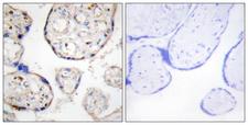 STEAP4 Antibody - Peptide - + Immunohistochemistry analysis of paraffin-embedded human placenta tissue, using STEAP4 antibody.
