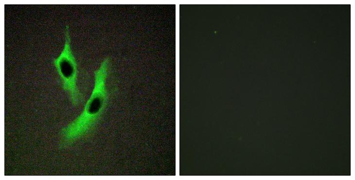 STEAP4 Antibody - Peptide - + Immunofluorescence analysis of Jurkat cells, using STEAP4 antibody.