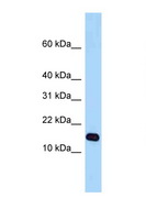 STH Antibody - STH antibody Western blot of Fetal Heart lysate. Antibody concentration 1 ug/ml.  This image was taken for the unconjugated form of this product. Other forms have not been tested.