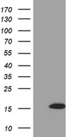 STH Antibody - HEK293T cells were transfected with the pCMV6-ENTRY control. (Left lane) or pCMV6-ENTRY STH. (Right lane) cDNA for 48 hrs and lysed. Equivalent amounts of cell lysates. (5 ug per lane) were separated by SDS-PAGE and immunoblotted with anti-STH. (1:2000)