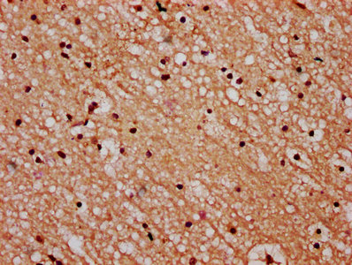 STH Antibody - Immunohistochemistry Dilution at 1:600 and staining in paraffin-embedded human brain tissue performed on a Leica BondTM system. After dewaxing and hydration, antigen retrieval was mediated by high pressure in a citrate buffer (pH 6.0). Section was blocked with 10% normal Goat serum 30min at RT. Then primary antibody (1% BSA) was incubated at 4°C overnight. The primary is detected by a biotinylated Secondary antibody and visualized using an HRP conjugated SP system.