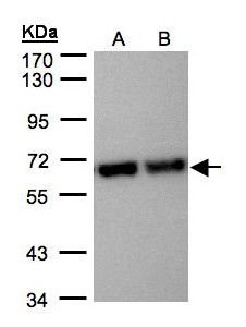 STI1 / STIP1 Antibody - Sample (30 ug of whole cell lysate). A: Hep G2, B: MOLT4. 7.5% SDS PAGE. STI1 / STIP1 antibody diluted at 1:5000