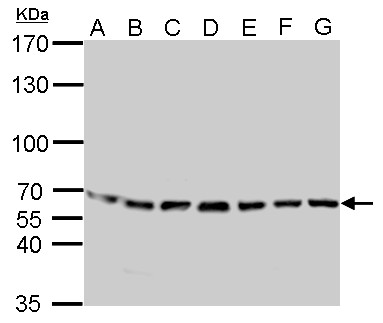 STI1 / STIP1 Antibody - STIP1 antibody detects STIP1 protein by Western blot analysis. A. 30 ug Neuro2A whole cell lysate/extract. B. 30 ug GL261 whole cell lysate/extract. C. 30 ug C8D30 whole cell lysate/extract. D. 30 ug NIH-3T3 whole cell lysate/extract. E. 30 ug BCL-1 whole cell lysate/extract. F. 30 ug Raw264.7 whole cell lysate/extract. G. 30 ug C2C12 whole cell lysate/extract. 7.5 % SDS-PAGE. STIP1 antibody dilution:1:1000