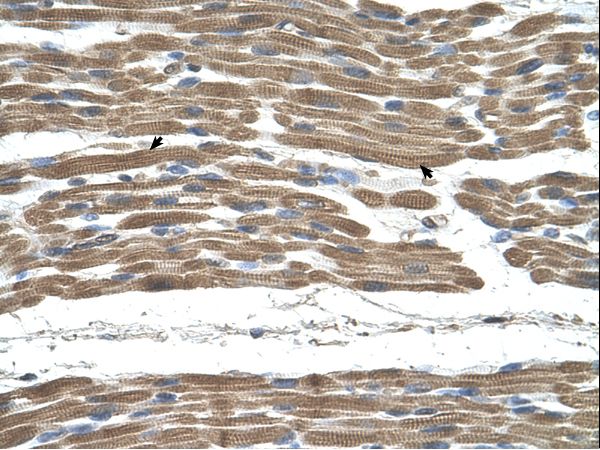 STI1 / STIP1 Antibody - STIP1 antibody STIP1(stress-induced-phosphoprotein 1 (Hsp70/Hsp90-organizing protein)) Antibody was used in IHC to stain formalin-fixed, paraffin-embedded human muscle.  This image was taken for the unconjugated form of this product. Other forms have not been tested.