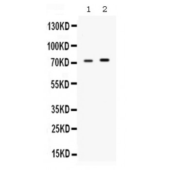STI1 / STIP1 Antibody - Western blot analysis of STIP1 expression in rat testis extract (lane 1) and MCF-7 whole cell lysates (lane 2). STIP1 at 73 kD was detected using rabbit anti- STIP1 Antigen Affinity purified polyclonal antibody at 0.5 ug/mL. The blot was developed using chemiluminescence (ECL) method.