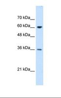 STI1 / STIP1 Antibody - Jurkat cell lysate. Antibody concentration: 1.25 ug/ml. Gel concentration: 12%.  This image was taken for the unconjugated form of this product. Other forms have not been tested.