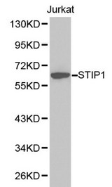STI1 / STIP1 Antibody - Western blot of STIP1 pAb in extracts from Jurkat cells.
