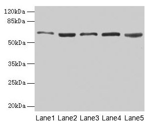 STI1 / STIP1 Antibody - Western blot All lanes: STIP1 antibody at 10µg/ml Lane 1: MCF-7 whole cell lysate Lane 2: Hela whole cell lysate Lane 3: A549 whole cell lysate Lane 4: HepG2 whole cell lysate Lane 5: PC-3 whole cell lysate Secondary Goat polyclonal to rabbit IgG at 1/10000 dilution Predicted band size: 63, 69, 60 kDa Observed band size: 63 kDa