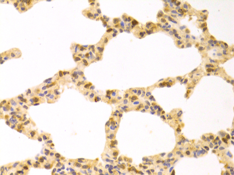 STI1 / STIP1 Antibody - Immunohistochemistry of paraffin-embedded rat lung tissue.