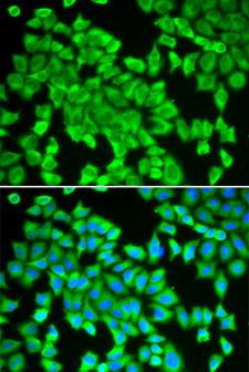 STI1 / STIP1 Antibody - Immunofluorescence analysis of HeLa cells using STIP1 antibody. Blue: DAPI for nuclear staining.