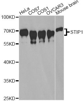 STI1 / STIP1 Antibody - Western blot analysis of extracts of various cell lines, using STIP1 antibody at 1:1000 dilution. The secondary antibody used was an HRP Goat Anti-Rabbit IgG (H+L) at 1:10000 dilution. Lysates were loaded 25ug per lane and 3% nonfat dry milk in TBST was used for blocking.