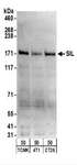 STIL Antibody - Detection of Mouse SIL by Western Blot. Samples: Whole cell lysate (50 ug) from TCMK-1, 4T1, and CT26.WT cells. Antibodies: Affinity purified rabbit anti-SIL antibody used for WB at 0.1 ug/ml. Detection: Chemiluminescence with an exposure time of 3 minutes.
