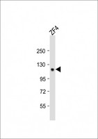 STIL Antibody - Anti-Zebrafish stil Antibody (C-term)at 1:2000 dilution + ZF4 whole cell lysates Lysates/proteins at 20 ug per lane. Secondary Goat Anti-Rabbit IgG, (H+L), Peroxidase conjugated at 1:10000 dilution. Predicted band size: 138 kDa. Blocking/Dilution buffer: 5% NFDM/TBST.