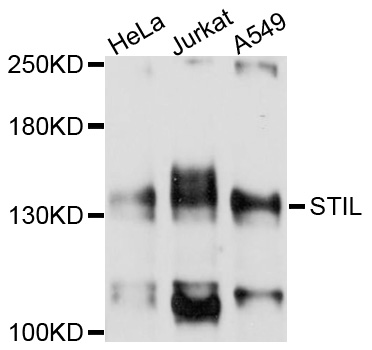 STIL Antibody - Western blot analysis of extracts of various cell lines, using STIL antibody at 1:1000 dilution. The secondary antibody used was an HRP Goat Anti-Rabbit IgG (H+L) at 1:10000 dilution. Lysates were loaded 25ug per lane and 3% nonfat dry milk in TBST was used for blocking. An ECL Kit was used for detection and the exposure time was 10s.