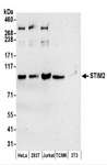 STIM2 Antibody - Detection of Human and Mouse STIM2 by Western Blot. Samples: Whole cell lysate (50 ug) prepared using NETN buffer from HeLa, 293T, Jurkat, mouse TCMK-1, and mouse NIH3T3 cells. Antibodies: Affinity purified rabbit anti-STIM2 antibody used for WB at 0.1 ug/ml. Detection: Chemiluminescence with an exposure time of 3 minutes.