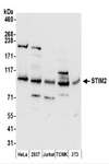STIM2 Antibody - Detection of Human and Mouse STIM2 by Western Blot. Samples: Whole cell lysate (50 ug) prepared using NETN buffer from HeLa, 293T, Jurkat, mouse TCMK-1, and mouse NIH3T3 cells. Antibodies: Affinity purified rabbit anti-STIM2 antibody used for WB at 0.4 ug/ml. Detection: Chemiluminescence with an exposure time of 30 seconds.