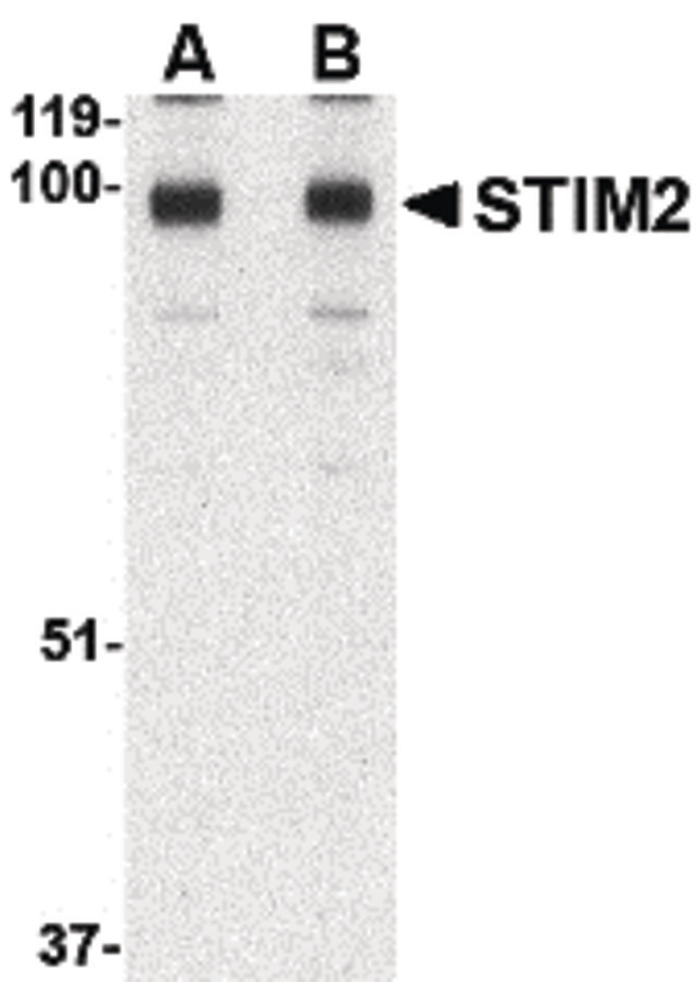 STIM2 Antibody - Western blot of STIM2 in A-20 cell lysate with STIM2 antibody at (A) 0.5 and (B) 1 ug/ml.