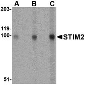STIM2 Antibody - Western blot of whole cell lysate from A20 mouse B-cell lymphoma cells probed with Rabbit anti-Human STIM2 at 0.5(A), 1(B) and 2(C) ug/ml