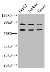 STIM2 Antibody - Positive WB detected in:HepG2 whole cell lysate,Jurkat whole cell lysate,Mouse heart tissue;All lanes: STIM2 antibody at 2.8ug/ml;Secondary;Goat polyclonal to rabbit IgG at 1/50000 dilution;Predicted band size: 84,94,69 kDa;Observed band size: 84,69 kDa;