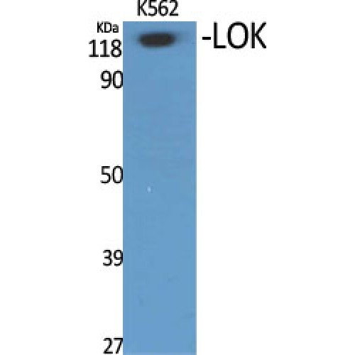 STK10 / LOK Antibody - Western blot of LOK antibody