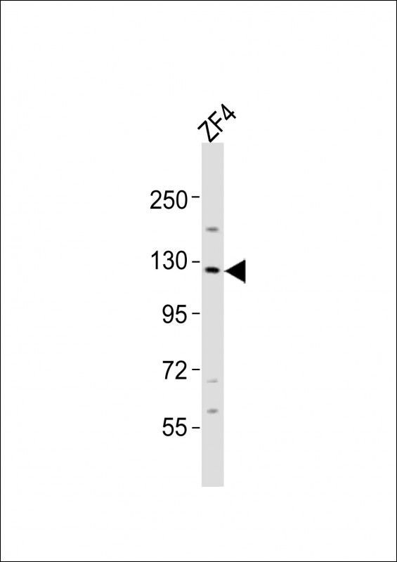 STK10 / LOK Antibody - Anti-stk10 Antibody at 1:2000 dilution + ZF4 whole cell lysates Lysates/proteins at 20 ug per lane. Secondary Goat Anti-Rabbit IgG, (H+L), Peroxidase conjugated at 1/10000 dilution Predicted band size : 114 kDa Blocking/Dilution buffer: 5% NFDM/TBST.