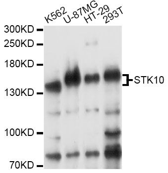 STK10 / LOK Antibody - Western blot analysis of extracts of various cell lines, using STK10 antibody at 1:3000 dilution. The secondary antibody used was an HRP Goat Anti-Rabbit IgG (H+L) at 1:10000 dilution. Lysates were loaded 25ug per lane and 3% nonfat dry milk in TBST was used for blocking. An ECL Kit was used for detection and the exposure time was 30s.