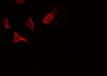 STK10 / LOK Antibody - Staining HeLa cells by IF/ICC. The samples were fixed with PFA and permeabilized in 0.1% Triton X-100, then blocked in 10% serum for 45 min at 25°C. The primary antibody was diluted at 1:200 and incubated with the sample for 1 hour at 37°C. An Alexa Fluor 594 conjugated goat anti-rabbit IgG (H+L) Ab, diluted at 1/600, was used as the secondary antibody.