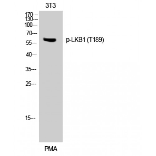 STK11 / LKB1 Antibody - Western blot of Phospho-LKB1 (T189) antibody
