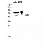 STK11 / LKB1 Antibody - Western blot of LKB1 antibody