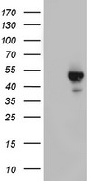 STK11 / LKB1 Antibody - HEK293T cells were transfected with the pCMV6-ENTRY control (Left lane) or pCMV6-ENTRY STK11 (Right lane) cDNA for 48 hrs and lysed. Equivalent amounts of cell lysates (5 ug per lane) were separated by SDS-PAGE and immunoblotted with anti-STK11.