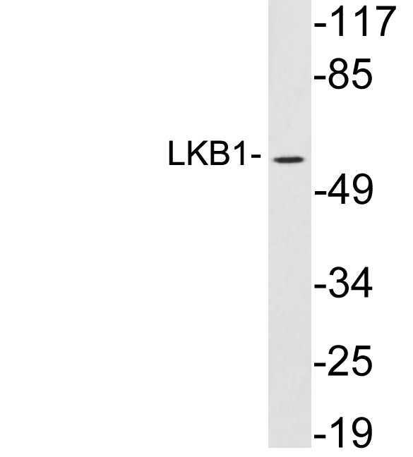 STK11 / LKB1 Antibody - Western blot analysis of lysates from HeLa cells, using LKB1 antibody.