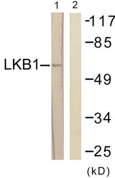STK11 / LKB1 Antibody - Western blot analysis of lysates from HeLa cells, treated with Serum 20% 15', using LKB1 Antibody. The lane on the right is blocked with the synthesized peptide.