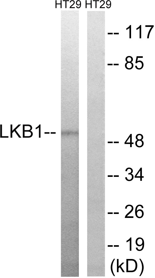 STK11 / LKB1 Antibody - Western blot analysis of lysates from HT-29 cells, using LKB1 Antibody. The lane on the right is blocked with the synthesized peptide.