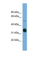 STK11 / LKB1 Antibody - STK11 / LKB1 antibody Western blot of HepG2 cell lysate. This image was taken for the unconjugated form of this product. Other forms have not been tested.