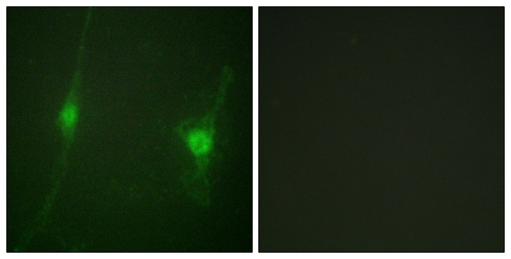 STK11 / LKB1 Antibody - Immunofluorescence analysis of NIH/3T3 cells, using LKB1 Antibody. The picture on the right is blocked with the synthesized peptide.