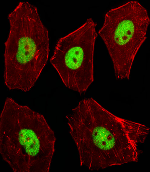 STK11 / LKB1 Antibody - Fluorescent image of A549 cells stained with XAF1 Mouse Stk11 Antibody. Antibody was diluted at 1:100 dilution. An Alexa Fluor 488-conjugated goat anti-rabbit lgG at 1:400 dilution was used as the secondary antibody (green). Cytoplasmic actin was counterstained with Alexa Fluor 555 conjugated with Phalloidin (red).