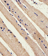 STK11 / LKB1 Antibody - Immunohistochemical of paraffin-embedded M.skeletal muscle section using Mouse Stk11 Antibody. Antibody was diluted at 1:25 dilution. A peroxidase-conjugated goat anti-rabbit IgG at 1:400 dilution was used as the secondary antibody, followed by DAB staining.